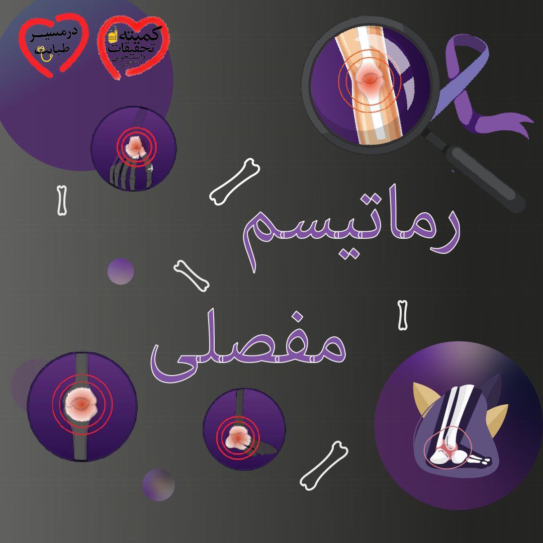 رماتیسم فصلی 